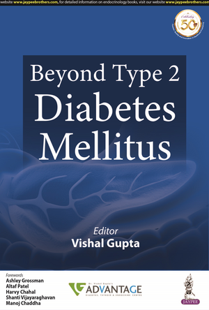 Beyond Type 2 Diabetes Mellitus de Vishal Gupta