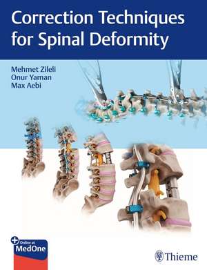 Correction Techniques for Spinal Deformity de Mehmet Zileli