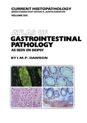 Atlas of Gastrointestinal Pathology: As Seen on Biopsy de M. Dawson