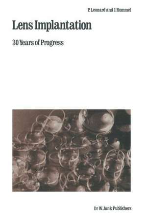 Lens Implantation: 30 Years of Progress de P. Leonard