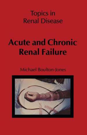 Acute and Chronic Renal Failure de M. Boulton-Jones