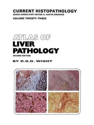 Atlas of Liver Pathology de D.G. Wight