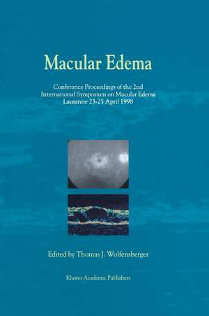 Macular Edema: Conference Proceedings of the 2nd International Symposium on Macular Edema, Lausanne, 23–25 April 1998 de Thomas J. Wolfensberger