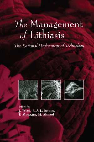 The Management of Lithiasis: The Rational Deployment of Technology de Jamsheer J. Talati