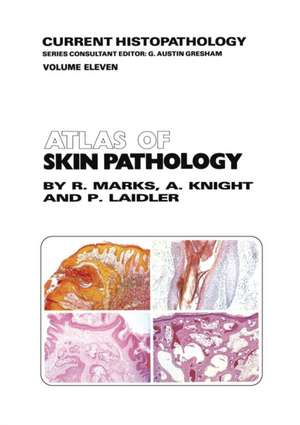 Atlas of Skin Pathology de R.M. Marks