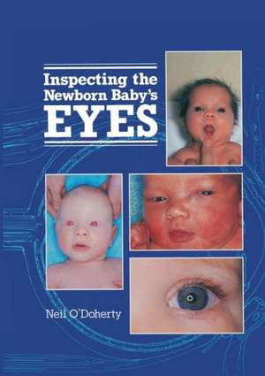 Inspecting the Newborn Baby's Eyes de N. O'Doherty