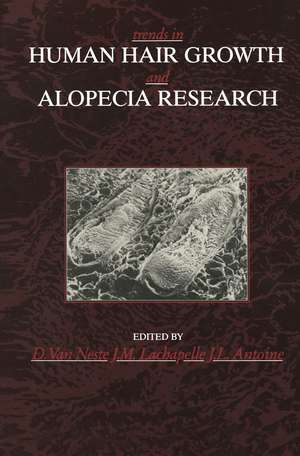 Trends in Human Hair Growth and Alopecia Research de Dominique van Neste