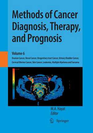 Methods of Cancer Diagnosis, Therapy, and Prognosis: Ovarian Cancer, Renal Cancer, Urogenitary tract Cancer, Urinary Bladder Cancer, Cervical Uterine Cancer, Skin Cancer, Leukemia, Multiple Myeloma and Sarcoma de M. A. Hayat