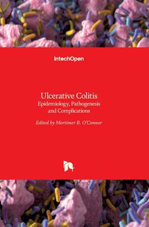 Ulcerative Colitis de Mortimer O'Connor