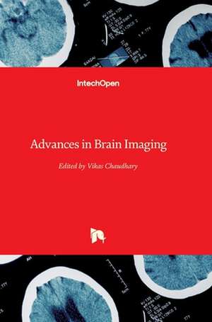 Advances in Brain Imaging de Vikas Chaudhary