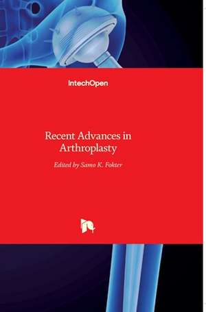 Recent Advances in Arthroplasty de Samo Fokter