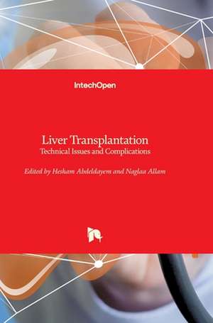 Liver Transplantation de Hesham Abdeldayem