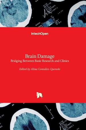 Brain Damage de Alina Gonzalez-Quevedo