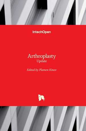 Arthroplasty de Plamen Kinov