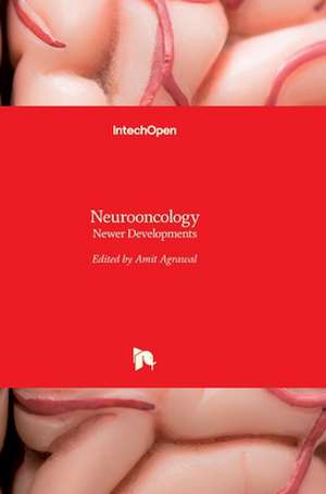 Neurooncology de Amit Agrawal