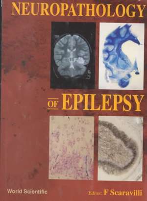 Neuropathology of Epilepsy de Francesco Scaravilli