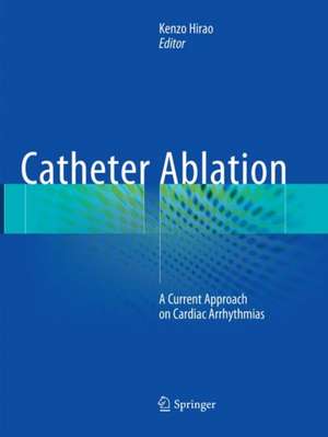 Catheter Ablation: A Current Approach on Cardiac Arrhythmias de Kenzo Hirao