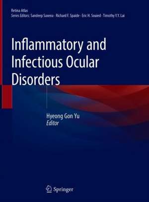 Inflammatory and Infectious Ocular Disorders de Hyeong Gon Yu