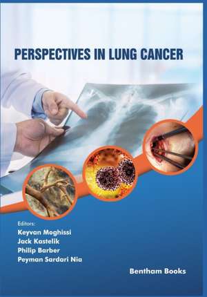 Perspectives in Lung Cancer de Jack Kastelik