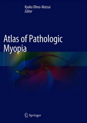 Atlas of Pathologic Myopia de Kyoko Ohno-Matsui