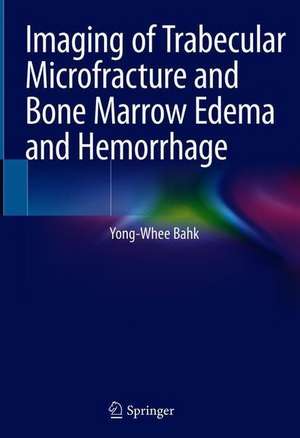 Imaging of Trabecular Microfracture and Bone Marrow Edema and Hemorrhage de Yong-Whee Bahk