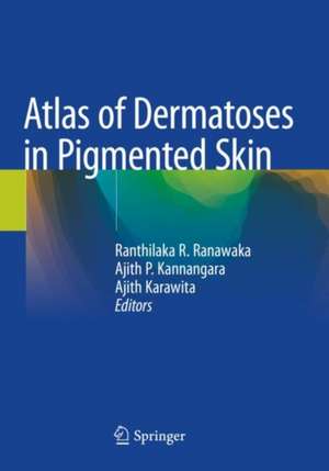 Atlas of Dermatoses in Pigmented Skin de Ranthilaka R. Ranawaka