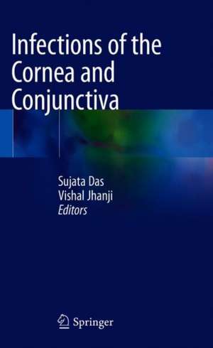 Infections of the Cornea and Conjunctiva de Sujata Das