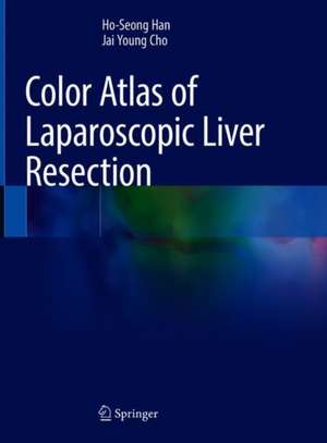 Color Atlas of Laparoscopic Liver Resection de Ho-Seong Han