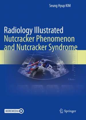 Radiology Illustrated: Nutcracker Phenomenon and Nutcracker Syndrome de Seung Hyup Kim