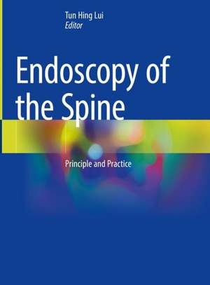 Endoscopy of the Spine: Principle and Practice de Tun Hing Lui