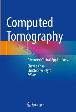 Computed Tomography: Advanced Clinical Applications de Shayne Chau