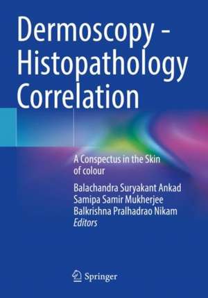 Dermoscopy - Histopathology Correlation : A Conspectus in the Skin of colour de Balachandra Suryakant Ankad