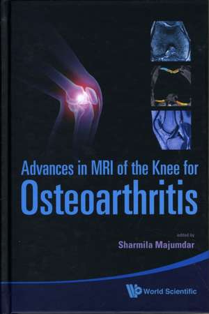 Advances in MRI of the Knee for Osteoarthritis de Sharmila Majumdar