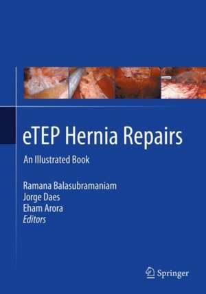 eTEP Hernia Repairs de Ramana Balasubramaniam