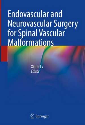 Endovascular and Neurovascular Surgery for Spinal Vascular Malformations de Xianli Lv