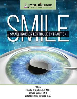 SMILE: Small Incision Lenticule Extraction de Claudio Orlich Dunddorf