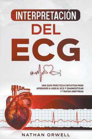 Interpretación del ECG de Nathan Orwell