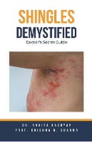 Sharma, K: Shingles Demystified