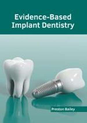 Evidence-Based Implant Dentistry de Preston Bailey