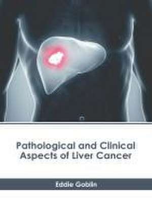 Pathological and Clinical Aspects of Liver Cancer de Eddie Goblin