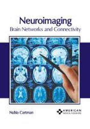 Neuroimaging: Brain Networks and Connectivity de Nubia Cartman