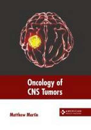 Oncology of CNS Tumors de Matthew Martin