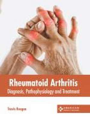 Rheumatoid Arthritis: Diagnosis, Pathophysiology and Treatment de Travis Reagan