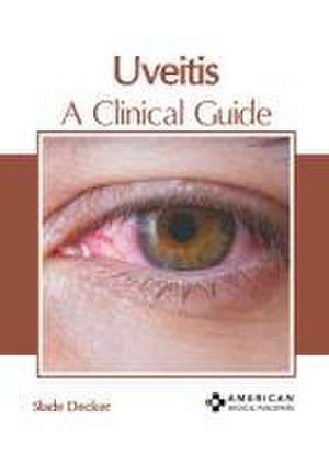 Uveitis: A Clinical Guide de Slade Decker