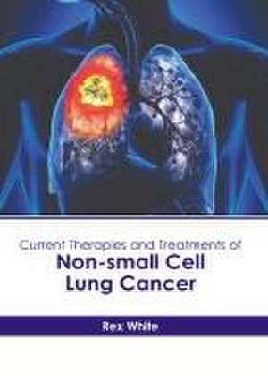 Current Therapies and Treatments of Non-Small Cell Lung Cancer de Rex White