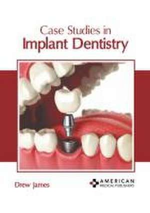 Case Studies in Implant Dentistry de Drew James