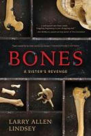 Bones de Larry Allen Lindsey