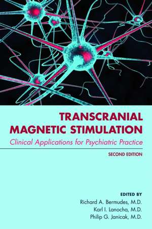 Transcranial Magnetic Stimulation de Karl Lanocha