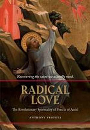 Radical Love de Anthony Profeta