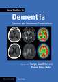 Case Studies in Dementia: Volume 1: Common and Uncommon Presentations